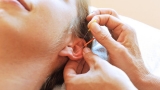 Ear Acupuncture